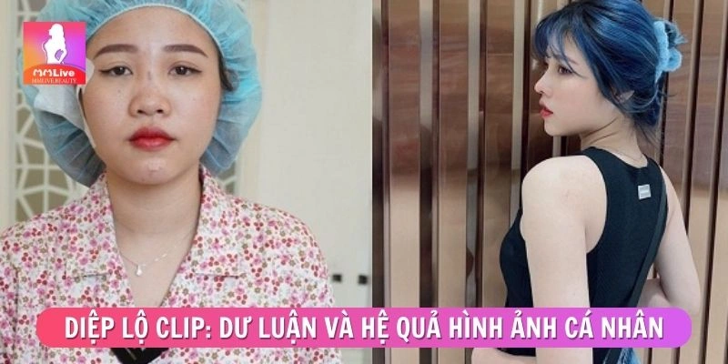Diệp lộ clip: Dư luận và hệ quả hình ảnh cá nhân